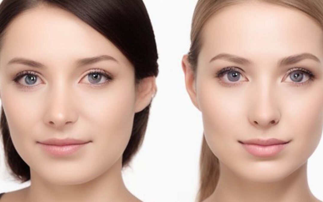 كيف أحافظ على نتيجة عملية تجميل الأنف و اتعافى بسرعة بيسيريا