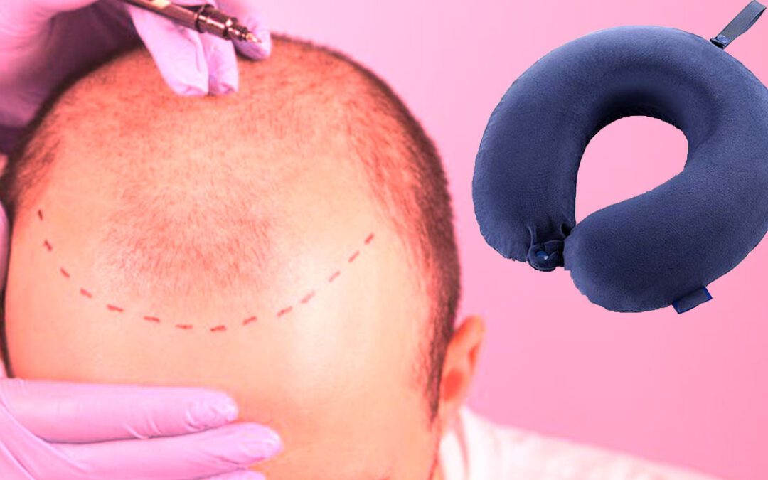 نصائح هامة بعد زراعة الشعر مقدمة من بيسيريا